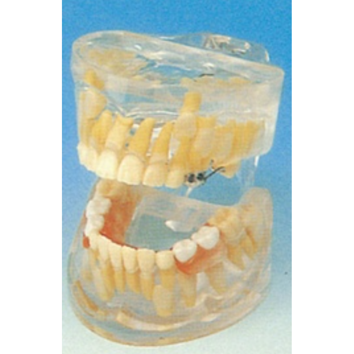 Milk Teeth Development Model